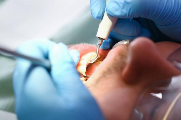 Best Weekend Emergency Dentist in Mukwonago, WI