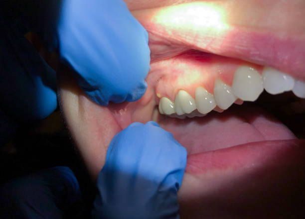 Best Emergency Dental Care for Trauma or Injury in Mukwonago, WI